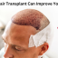 fue hair transplant